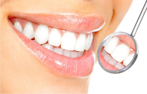 Как отбелить зубы в домашних условиях - эффективные способы 2