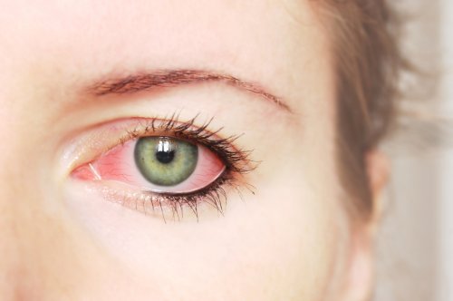 Что вызывает раздражение глаз Основные причины раздражения глаз 1