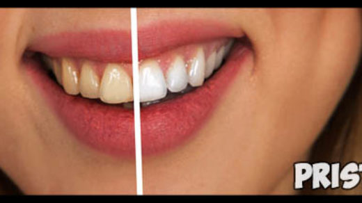 Как правильно ухаживать за зубами - рекомендации и советы 1
