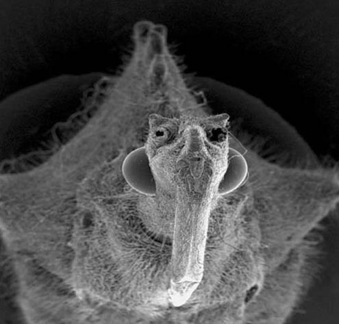 Микробы под микроскопом для детей - картинки и фото не для слабонервных 11
