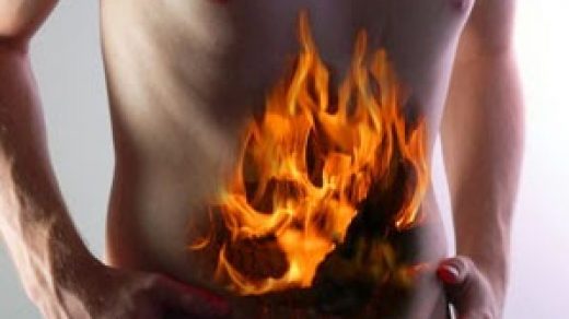 Как вылечить изжогу навсегда в домашних условиях - причины изжоги 3