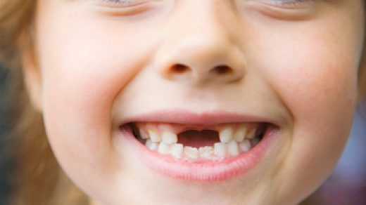 Какие зубы меняются у детей - выпадение молочных зубов и их смена 2