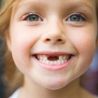 Какие зубы меняются у детей - выпадение молочных зубов и их смена 2