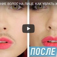 Как убрать или удалить женские усики на лице - интересное видео
