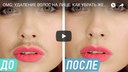 Как убрать или удалить женские усики на лице - интересное видео