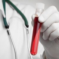 Почему повышается билирубин Повышенный билирубин в крови 1