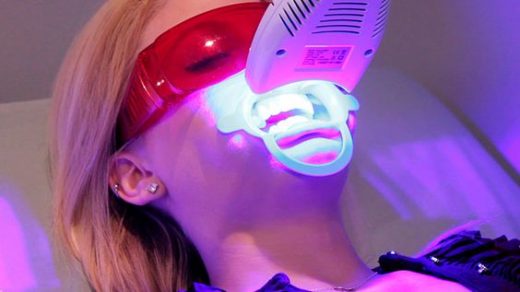 Лазерное отбеливание зубов плюсы и минусы 1